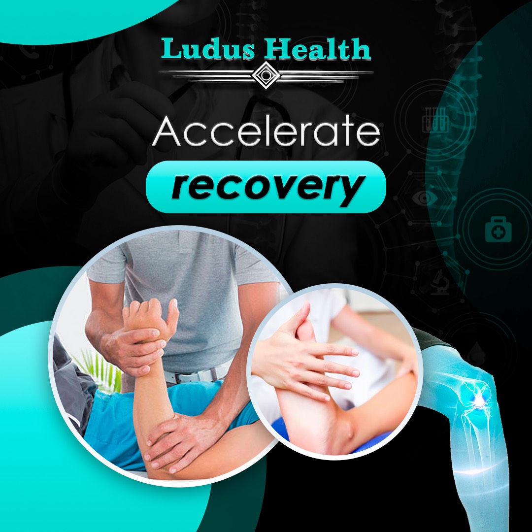 Acelerate recovery